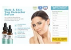 SkinFix Skin Tag Remover: Ingredients, Price, Working, Benefits & Buy Now?