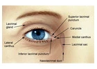 Oculoplasty Procedure In Delhi