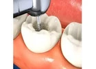 Book Your Appointment at the Best Dental Clinic in Kolkata