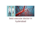 best vascular doctor in hydrabad 