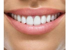 Midway Dental Lab: Revolutionizing Smiles with Custom Dental Aligners