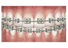 Gibb Orthodontics: Best Dentist Lethbridge 