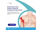 Robotic Heart Valve Surgery: Advanced Procedure For Heart Health