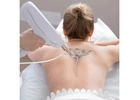 Acquire Best Tattoo Removal Treatment in Queensland from Envy Aesthetics