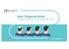 Hair Regeneration Treatment in Fresno