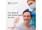 Non Surgical Hair Replacement For Men